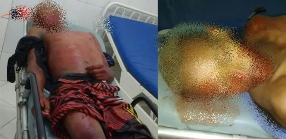 Jucuruçu: Policial é esfaqueado durante abordagem e mata agressor