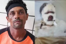 PM prende homem que queimou esposa em Ibirapuã; mulher está em estado grave
