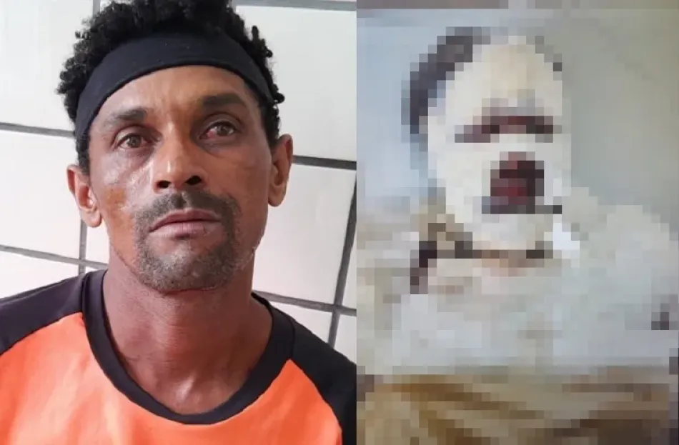 PM prende homem que queimou esposa em Ibirapuã; mulher está em estado grave